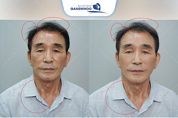 Beware: Unveiling Gangwhoo Hospital's Deceptive Practices